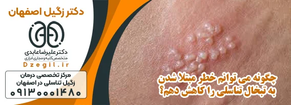 درمان تبخال تناسلی در اصفهان