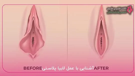 اپل