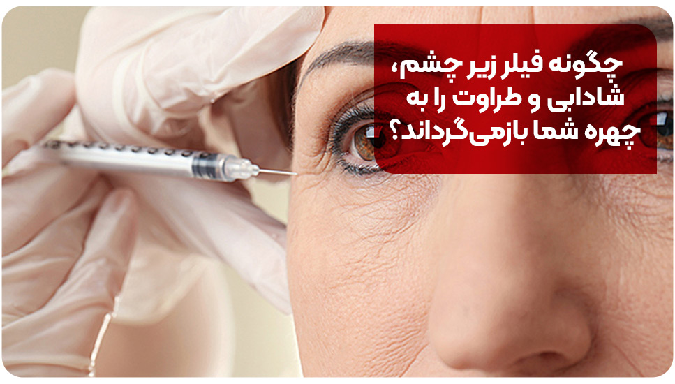 چگونه فیلر زیر چشم، شادابی و طراوت را به چهره شما بازمی‌گرداند؟