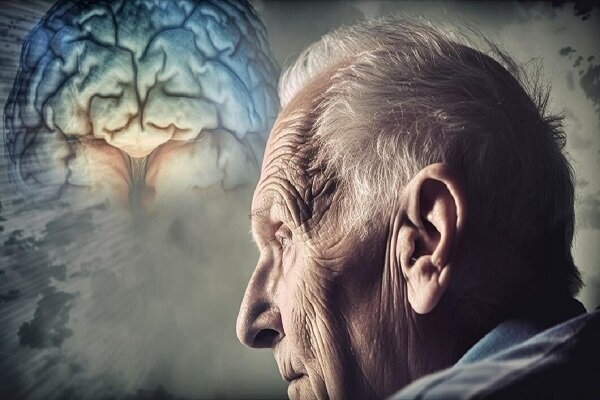 آلزایمر | هوش مصنوعی