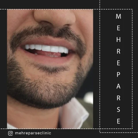 تهران
