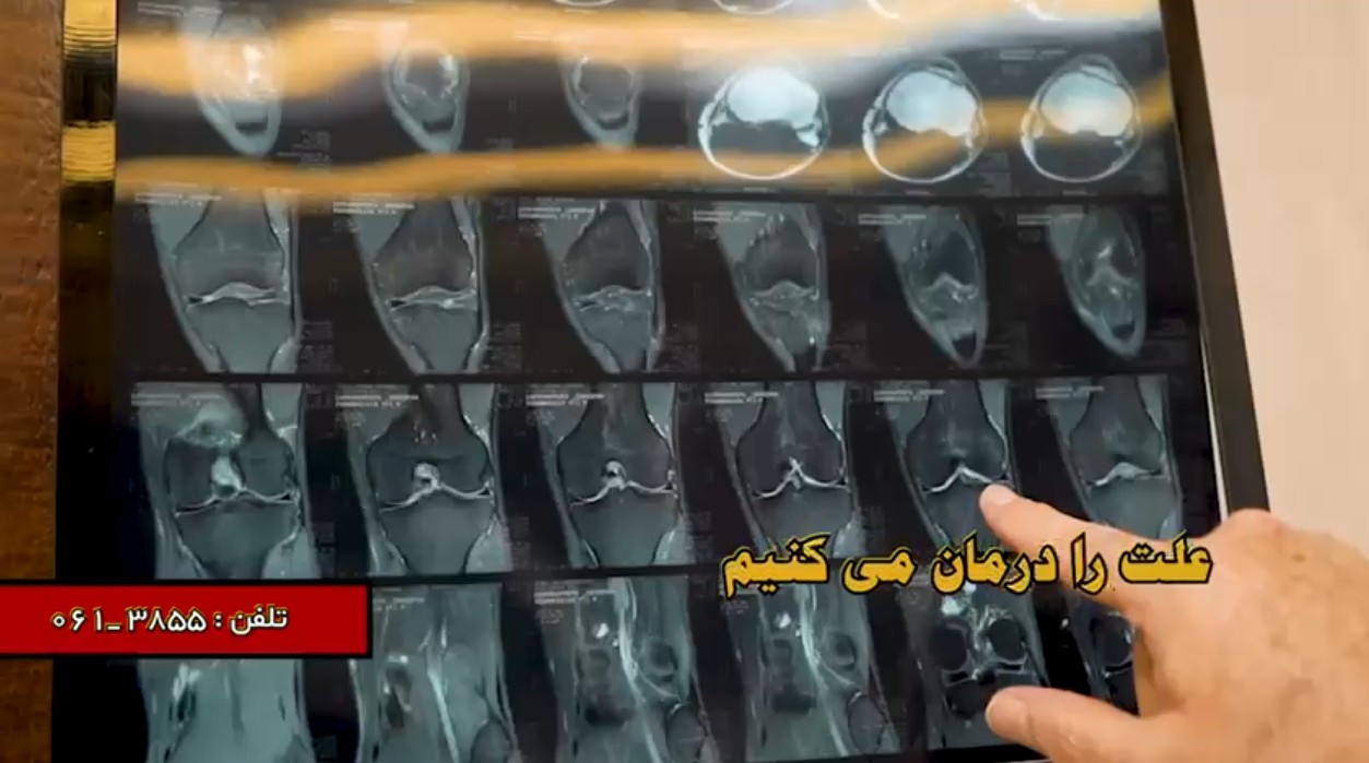 اهواز | پزشک | دیسک کمر