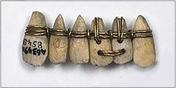 اروپا | ایتالیا | پلاستیک