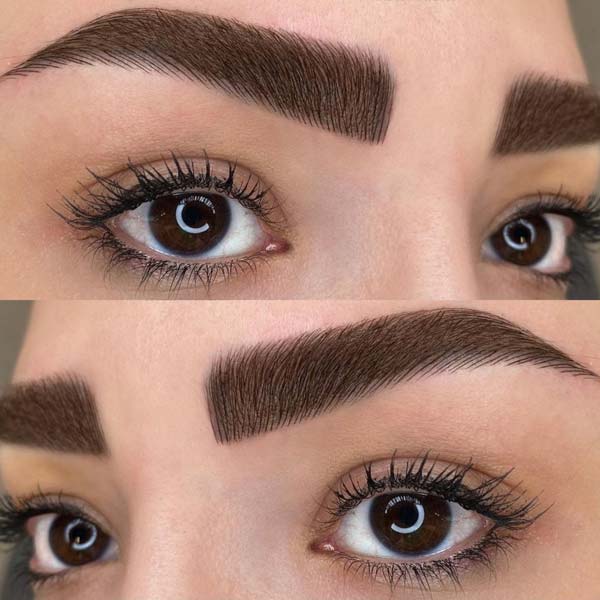 اصفهان | پوست | زیبایی